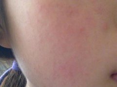 西宁看皮炎好的医院是哪里