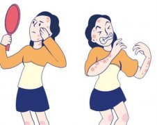 西宁好的体癣治疗医院