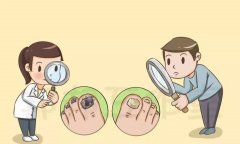 西宁治灰指甲哪个医院好